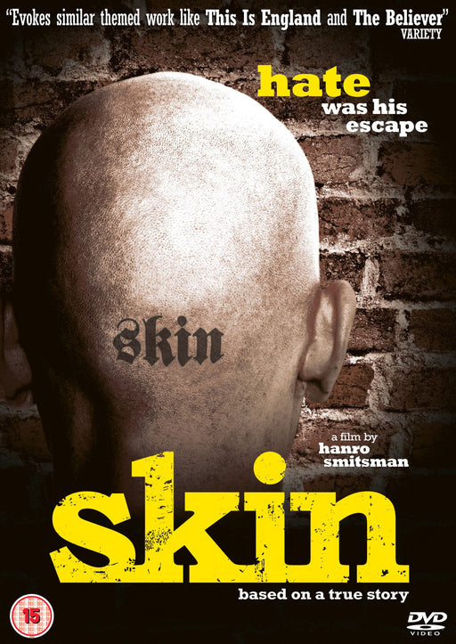 Skin [DVD] 2008 [Region 2] (Rare Drama / History Film) [True Story] - New Sealed - Attic Discovery Shop